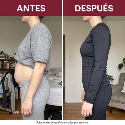 Voryn™ - Complejo Anti-Hinchazón