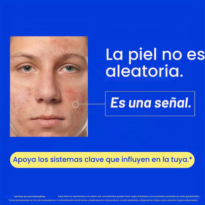 Voryn™ - Suplemento Acné